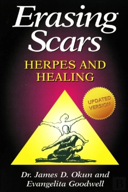 Bertrand.pt - Erasing Scars