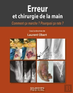 Bertrand.pt - Erreur Et Chirurgie De La Main