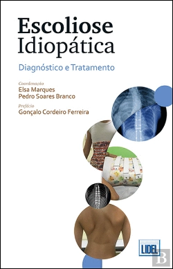 Bertrand.pt - Escoliose Idiopática