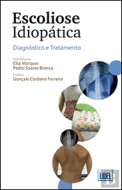 Escoliose Idiopática