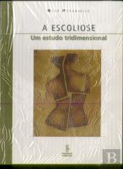 Escoliose