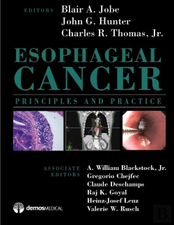 Bertrand.pt - Esophageal Cancer