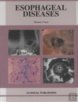 Bertrand.pt - Esophageal Diseases