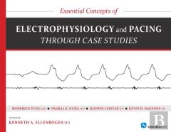 Essential Concepts Of Electrophysiology And Pacing Through Case Studies