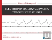 Essential Concepts Of Electrophysiology And Pacing Through Case Studies