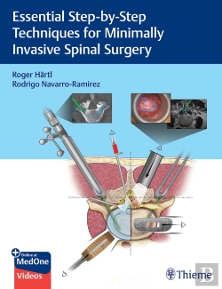 Bertrand.pt - Essential Step-By-Step Techniques For Minimally Invasive Spinal Surgery