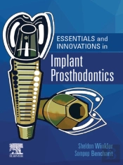 Essentials And Innovations In Implant Prosthodontics - E-Book