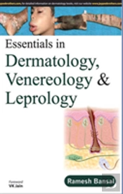 Essentials In Dermatology, Venereology & Leprology