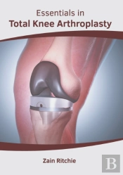 Essentials In Total Knee Arthroplasty