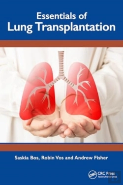 Bertrand.pt - Essentials Of Lung Transplantation