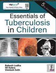 Essentials Of Tuberculosis In Children