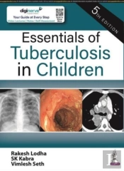 Essentials Of Tuberculosis In Children