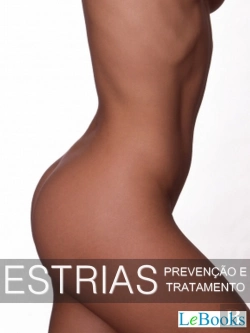 Bertrand.pt - Estrias