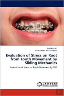 Bertrand.pt - Evaluation Of Stress On Root From Tooth Movement By Sliding Mechanics