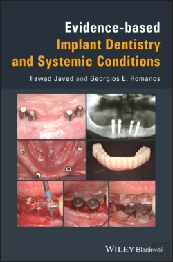 Bertrand.pt - Evidence-Based Implant Dentistry And Systemic Conditions