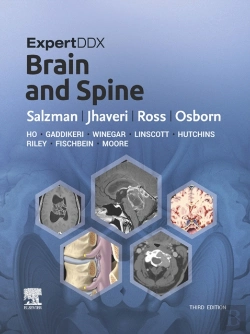 Bertrand.pt - Expertddx: Brain And Spine E-Book