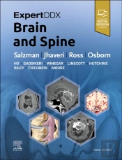 Expertddx: Brain And Spine
