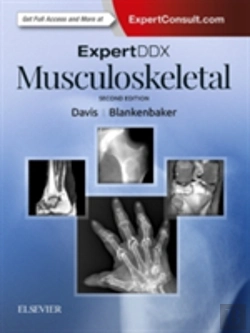 Bertrand.pt - Expertddx: Musculoskeletal