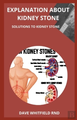 Bertrand.pt - Explanation About Kidney Stone