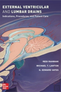 Bertrand.pt - External Ventricular And Lumbar Drains: Indications, Procedures, And Patient Care