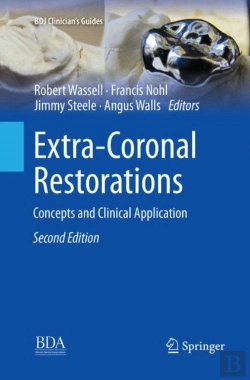 Bertrand.pt - Extra-Coronal Restorations