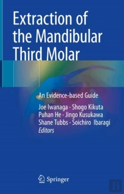 Bertrand.pt - Extraction Of The Mandibular Third Molar