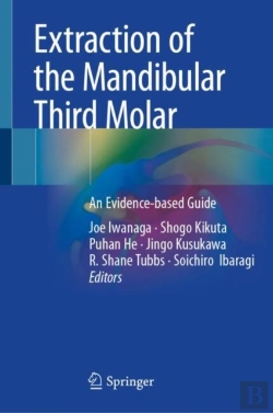 Bertrand.pt - Extraction Of The Mandibular Third Molar