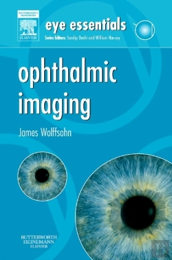 Bertrand.pt - Eye Essentials: Ophthalmic Imaging E-Book