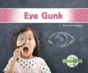 Eye Gunk
