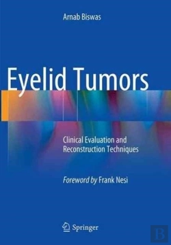 Bertrand.pt - Eyelid Tumors
