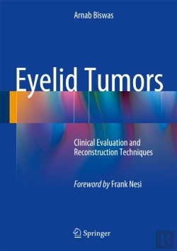 Bertrand.pt - Eyelid Tumors