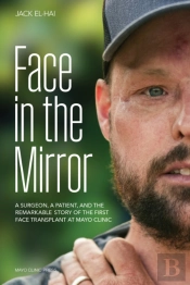 Face Transplant