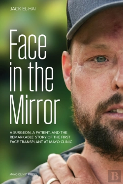 Bertrand.pt - Face Transplant