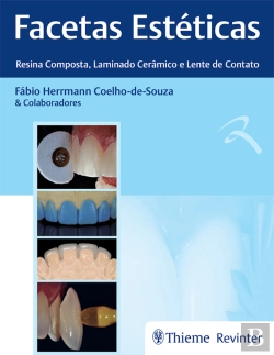 Bertrand.pt - Facetas Estéticas – Resina Composta, Laminado Cerâmico E Lente De Contato