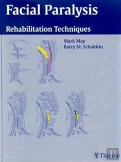 Bertrand.pt - Facial Paralysis