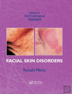 Bertrand.pt - Facial Skin Disorders