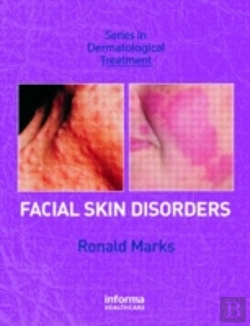 Bertrand.pt - Facial Skin Disorders