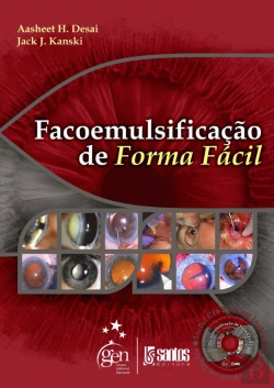 Bertrand.pt - Facoemulsificação de Forma Fácil