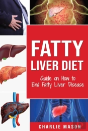 Fatty Liver Diet: Guide On How To End Fatty Liver Disease: Fatty Liver Diet Books
