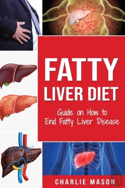 Bertrand.pt - Fatty Liver Diet: Guide On How To End Fatty Liver Disease: Fatty Liver Diet Books