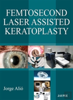 Bertrand.pt - Femtosecond Laser Assisted Keratoplasty