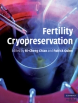 Bertrand.pt - Fertility Cryopreservation