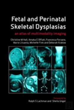 Bertrand.pt - Fetal And Perinatal Skeletal Dysplasias