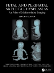 Fetal And Perinatal Skeletal Dysplasias
