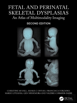 Bertrand.pt - Fetal And Perinatal Skeletal Dysplasias