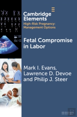 Bertrand.pt - Fetal Compromise In Labor