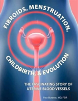 Bertrand.pt - Fibroids, Menstruation, Childbirth, And Evolution