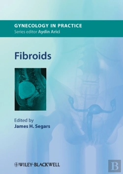Bertrand.pt - Fibroids
