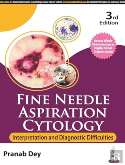 Bertrand.pt - Fine Needle Aspiration Cytology