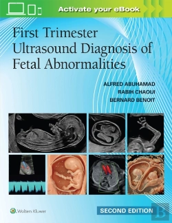 Bertrand.pt - First Trimester Ultrasound Diagnosis Of Fetal Abnormalities